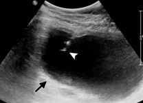 10313383_721169537926426_7904407686160146746_n